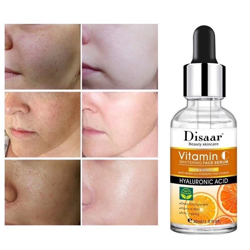 Vitamin C Set 5in1 (Cream, Toner, Serum & More)